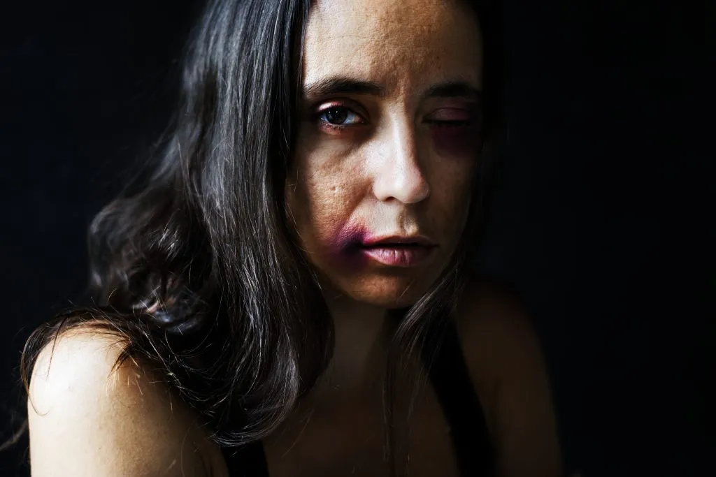 An image of a woman showing signs of abuse, looking distressed and vulnerable.